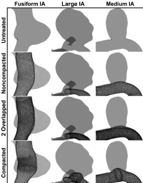 FIG 1. FD deployment results in all 3 IAs.