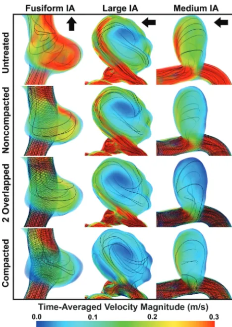 FIG 4. Time-averaged, volume-rendered velocity magnitude in all 3IAs for each FD strategy