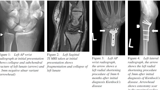 Figure 1: Left AP wrist 