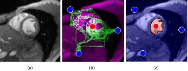 Figure 3. The results of (a) Original image (b) the maximum flow and (c) minimum cut algorithms