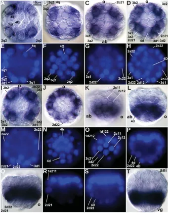 Fig. 3. Expression of HeSallof the embryo shown in k. Consecutive optical section of r