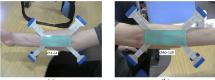 Fig.  1.  Positioning  of  the  two  64-channel  electrodes  on  (a)  flexor  muscles  and (b) extensor muscles
