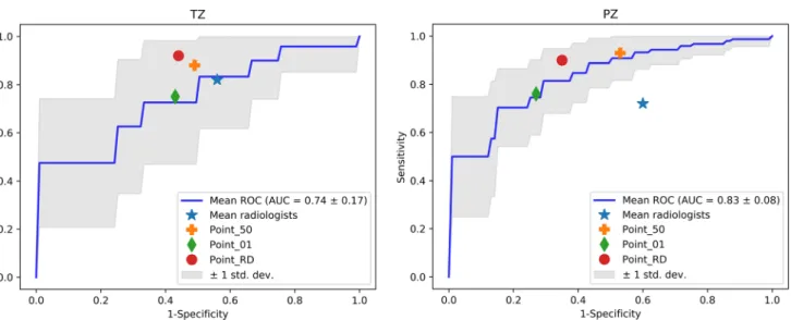 Table 5 Mean values of sensitivity (SN) and specificity (SP) at the three cut-off points  ob-tained by the three  radi-ologists and the best performing classifiers following fivefold  cross-validation SN SPTZNB point_500.88 0.51NB point_010.750.57NB point_
