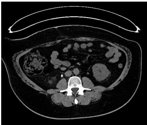 Fig. 1. UP-03.10. ULDCT.