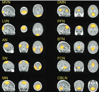 FIG 1. RSNs (44). MVN indicates medial visual network; LVN, lateral visual network; AN, auditory network; SN,salience network; MN, motor network; PFN, prefrontal network; BTN, brain stem and thalami;z � 2.6) identiﬁed by group independent component analysis in preterm infants (n �FCN, frontal cortical network; and CBLN, cerebellum network.