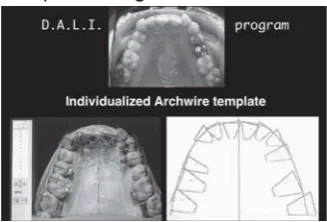 Figure 5: The Electronic TARG has a precise measuring device thatmeasures the distance (thickness) between the labial surface ofthe tooth and the slot of the bracket.