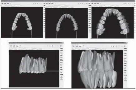 Figure 9: KIS system; all brackets are positioned