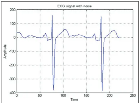 Fig. 4: Hardware architecture of comparator array