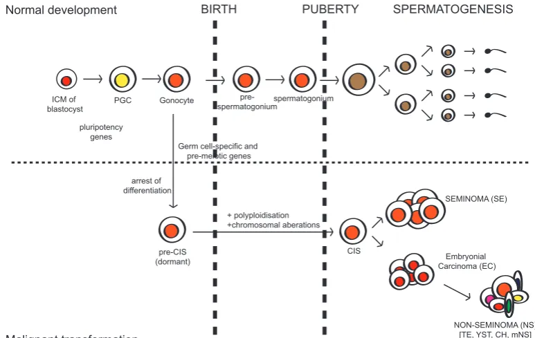 Fig. 1. Developmental origin of human type II TGCT. During normal germ cell development pluripotency genes are turned off as fetal germ cells differentiate into spermatogonia