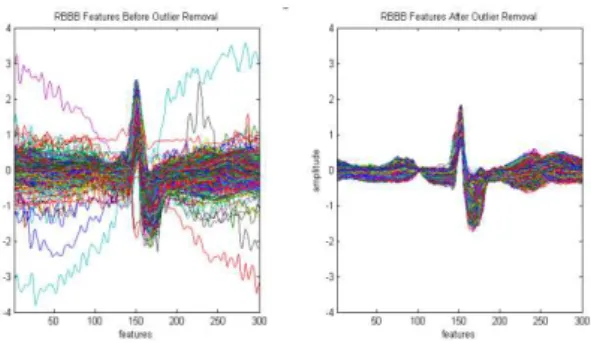 Figure 3. Beat segmentation result for class RBBB and  class PVC 