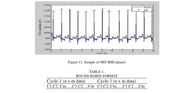 Figure 11. Sample of MIT-BIH dataset 