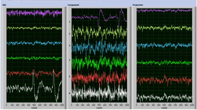 Fig. 6 Illustration of the on-line preprocessing module – artifact rejection: actual EEG  data (left), estimated automatically-ranked independent components - the first and the  last components were rejected as artifacts (center), back-projected (enhanced)