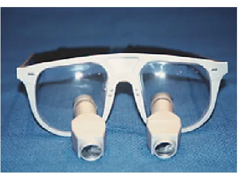 Fig 2: Simple loupe