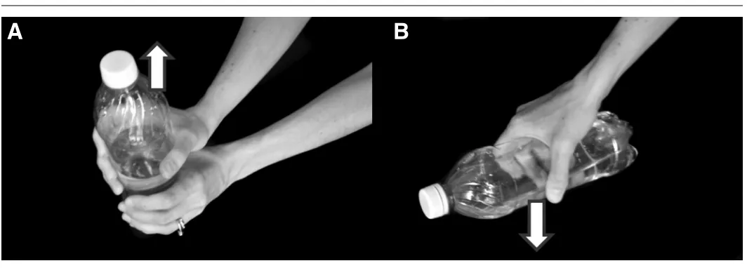 Figure 3 Kinesiology tape for De Quervain’s. Tape is placed without tension for a relaxation effect from the insertion (I) to the origin (O) [Figure 3A: without, and Figure 3B: with a corrective strip over the snuff box and parallel to tendons]19