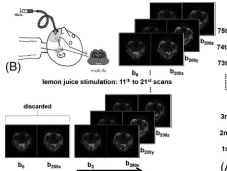 FIG 1. Demonstration of data acquisition and arrangement of DWI. A,The ﬁrst 2 images were discarded