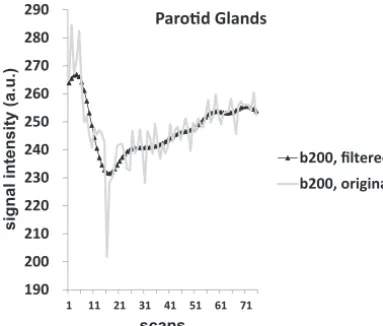 FIG 2. Signal intensity–time curves before and after ﬁfth-order But-terworth low-pass ﬁltering on DWI (b200)