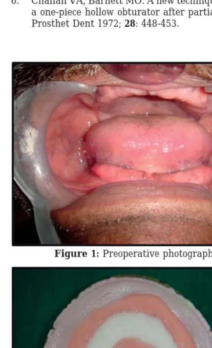 Figure 1: Preoperative photograph