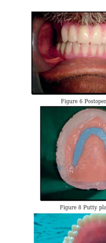 Figure 6 Postoperative photograph