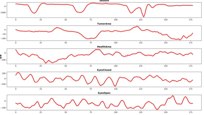 Figure 1. A demonstration of EEG recordings. An example of each brain activity was randomly selected and visualized