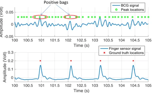 Figure 1.4: BCG signal and ground truth plot