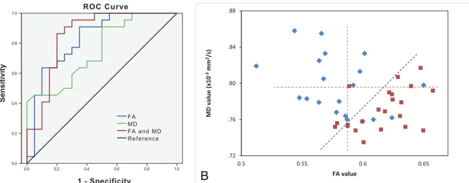 FIG 6. ADM-MCI and DM-NC patients., ROC curves for FA (blue), MD (green), and a combination of FA and MD (red) of the right cingulum (hippocampus) for separating B, Scatterplots of FA versus MD for all patients with DM-NC (red) and DM-MCI (blue)