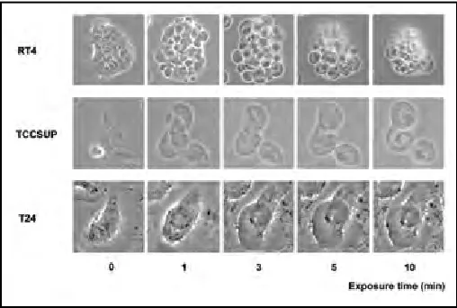 Fig. 1. Representative images of RT4, TCCSUP and T24 cells before and after exposure to sterile water