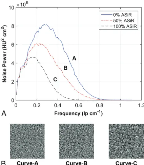 FIG 1. Texture of image noise as it appears in reconstructed imagesROI of 128appearance of the noise texture as it correlates with a 32% shift in NPSmean frequency along the abscissa from curve A to B and a 52% shiftchanges as the mean of the NPS curve shi
