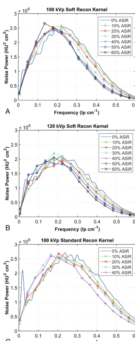 FIG 3. Noise power spectra acquired with the soft reconstructionkernel at 100 kVp from 240 to 120 mA (A), with the soft reconstructionkernel at 120 kVp from 200 to 110 mA (B), and the standard reconstruc-tion kernel at 100 kVp from 250 to 140 mA (C)