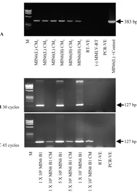 Fig. 1. Actb and Pdx1 RT-PCR results for cultured MIN6 cellsand corresponding CM.