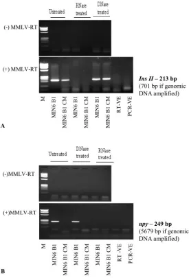 Fig. 2. Cell and CM RNA isolates treated with RNase orDNase before cDNA formation, MMLV reverse transcriptaseNpytreatment, and subsequent amplification with Ins2 (A) and (B) primers.