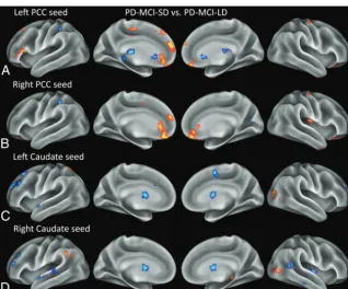 Table 3).group showed decreased frontostriatal RSFC, which was corre-