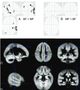 FIG 3. Average activation maps for the fMRI perception task for BF (top row) and MF (bottom row) children