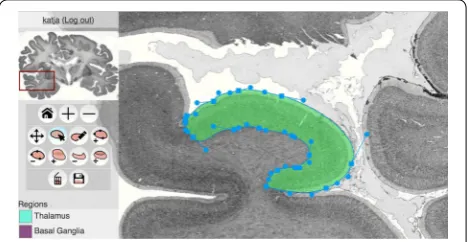 Figure 1: Screenshot from the application at http://microdraw.pas-teur.fr