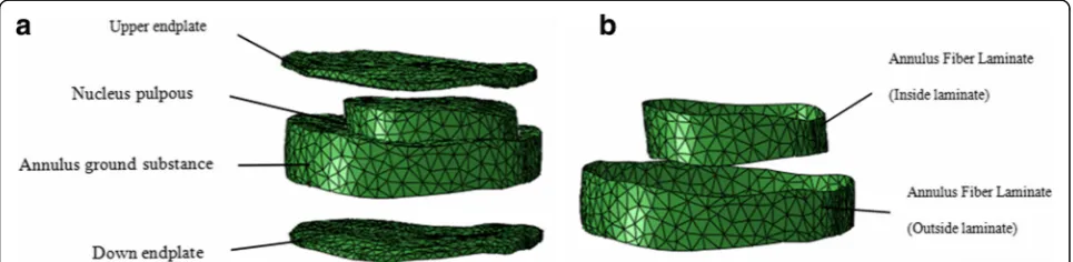 Fig. 1 FE models of the whole lumbar spine S1-L1 combined with a compressive follower preload
