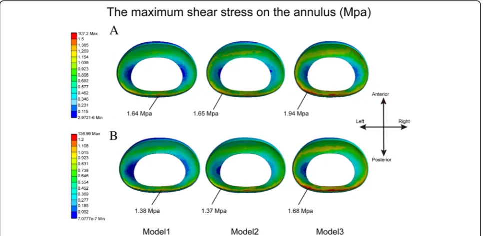 Fig. 8 The nephogram of shear stress on the annulus in L5 disc. a. In flexion. b. In axial rotation