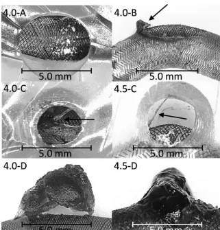FIG 3. Thrombi after the blood experiments. Experiments 4.0-A and 4.0-B show no thrombus orthe beginning of a thrombus; 4.0-C and 4.5-C show a ﬁbrin network, anchored at the proximal sideof the aneurysm in the FD and extended across the aneurysm up to the 