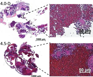 FIG 4. H&E-stainedsectionsofthethrombiresultingfromexperiments4.0-Dand4.5-D.Erythrocyte-rich areas are stained dark red, whereas ﬁbrin-and platelet-rich areas are stained a light pink