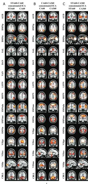 FIG 2. ICA results of each dataset pair.motor network (SSMala) was identiﬁed in STA60-CA60 and STA60-CA360 analyses, and the medial visual network (VISme) was identiﬁed inCA60-CA360 analysis