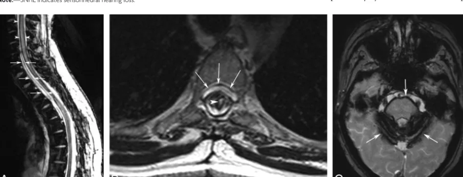 FIG 3. Anterior ﬂuid collection and spinal and brain siderosis that developed 10 years after the operation for STSCH