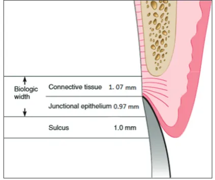 Figure 1: Picture showing average human biological width, epithelium: 0.97 mm, and connective tissue: 1.07 mm