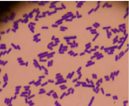 Fig. 1 Gram assay of isolate DS15 under a 1000 x magnification of light microscope. 