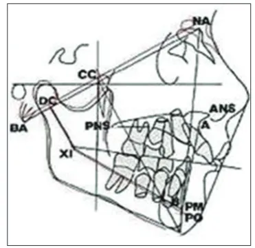 Figure 3: Steps in Rickett’s visual treatment objective