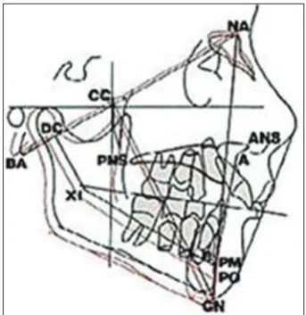Figure 7: Steps in Rickett’s visual treatment objective