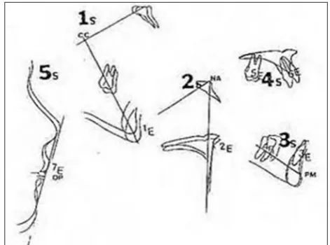Figure 14: Steps in Holdaway’s visual treatment 
