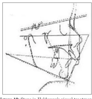 Figure 18: Steps in Holdaway’s visual treatment 