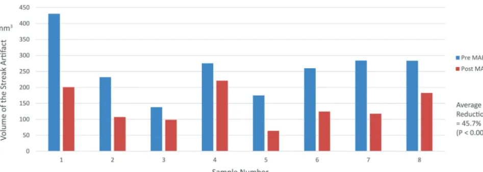 FIG 5. Quantitative analysis of streak artifacts. A graph compares the volume of streak artifacts of the pre- and post-MAR images