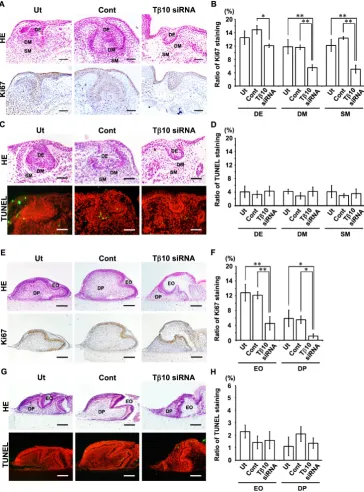Fig. 8. Cell proliferation and cell death activity in cultured E11.0 mandibles mand E15.0 tooth germs treated with Tb10-siRNA
