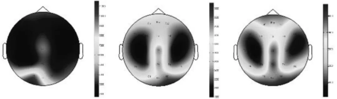 Figure 1. – Delta (1-4.5 Hz) power maps of the 3 age groups (from left to right: 1. age group (4.64土0.45 years), 2
