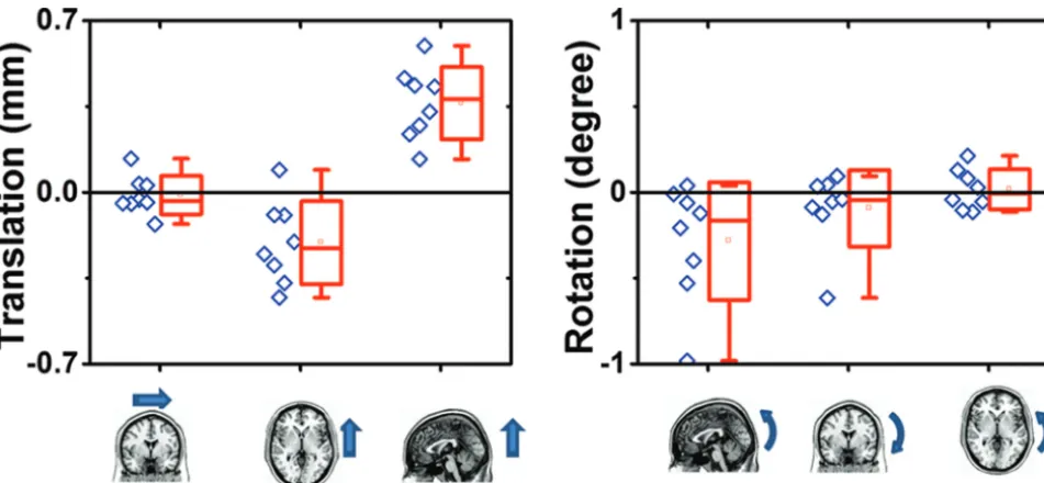 FIG 4.Correlation between brain rotation and ventricle volumechanges. Without the potential outlier, which was the subject thatdemonstrated the largest ventricles before bed rest, the Spearmancorrelation is r � 0.893, P � .007