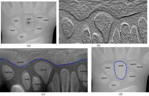 Fig.  4  (a) carpal bones ROI with 36 radial lines emanating from the capitate centroid (b) cost image after polar transform with radial lines Rminimum cost path overlaid on the polar (d)   segmented capitate bone boundary overlaid on the Cartesian image
